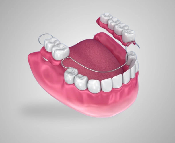 full and partial dentures in fort worth tx - titanium dental & implants