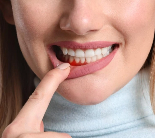 periodontal care in fort worth tx - titanium dental & implants